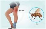 Do Hover Bees Sting?
