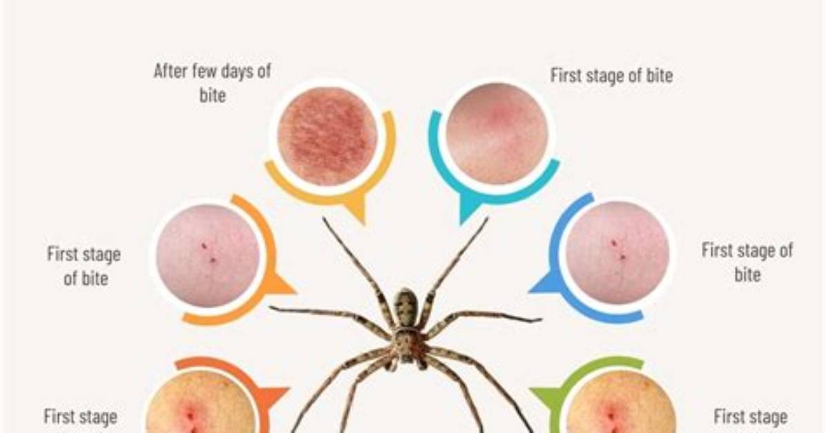 Do Huntsman Spiders Bite
