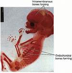 Do Intramembranous Bones Develop?
