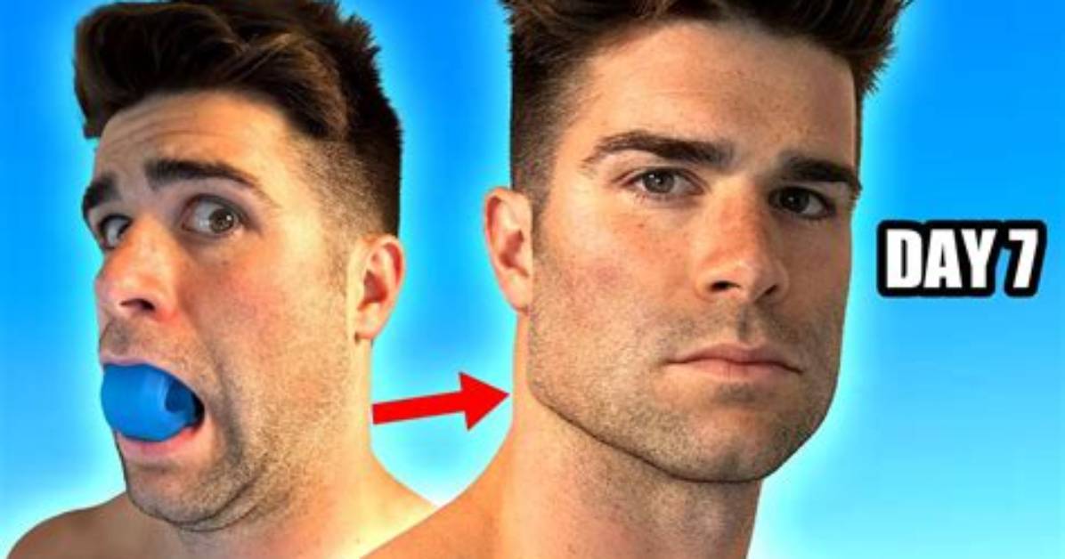 Do Jaw Definers Work?