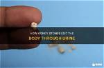 Do Kidney Stones Float When Passed?