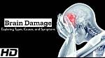 Do Knockouts Cause Brain Damage?