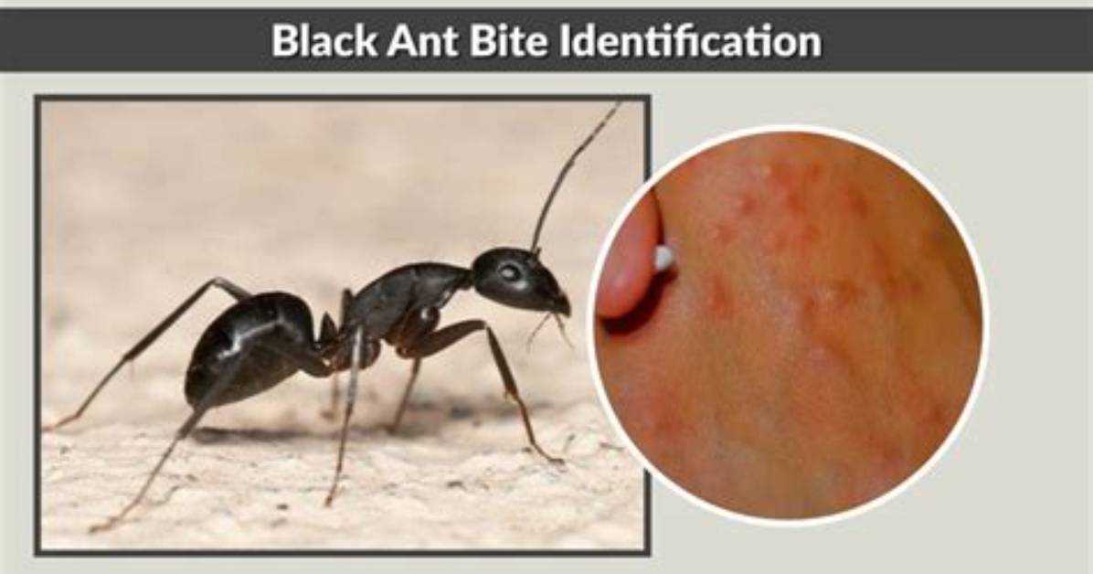 Do Large Black Ants Bite?
