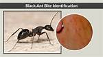 Do Large Black Ants Bite?