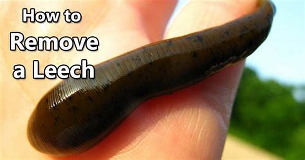 Do Leeches Hurt