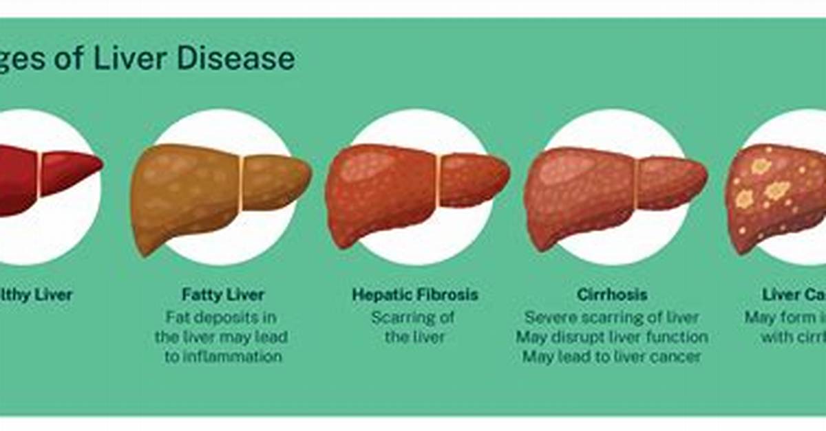 Do Liver Problems Cause Diarrhea?