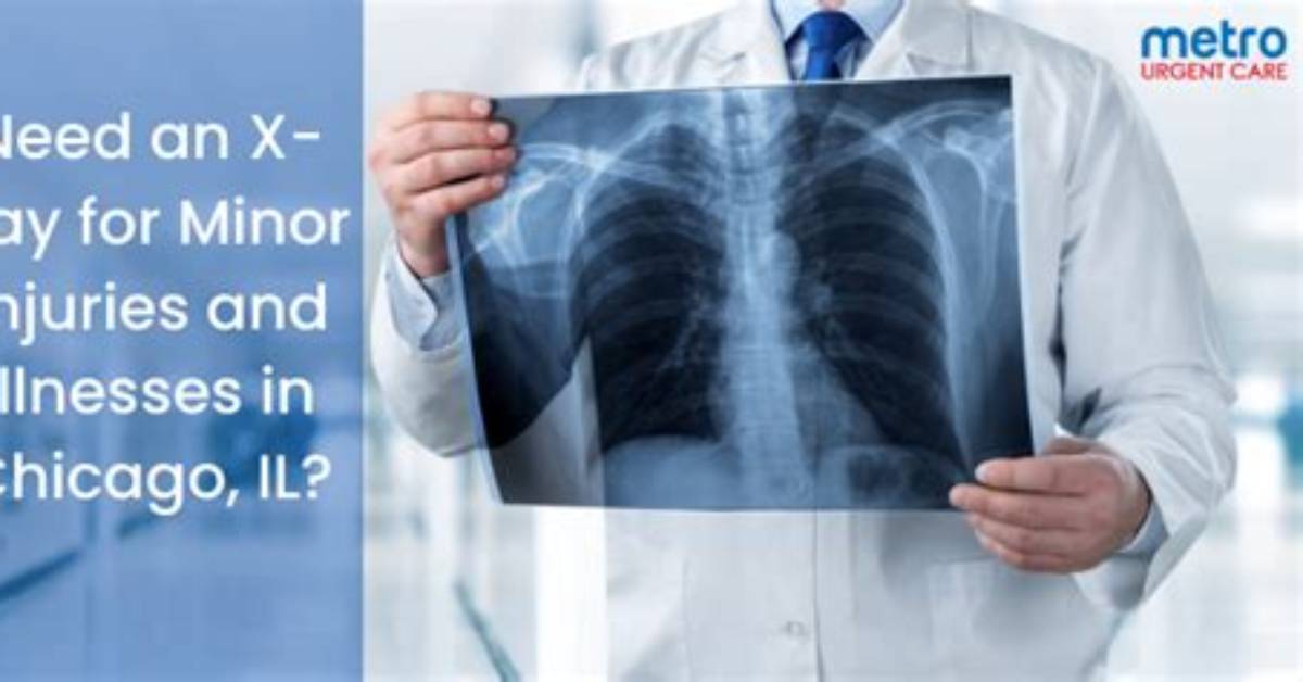 Do Minor Injuries Do X Rays?