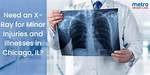 Do Minor Injuries Do X Rays?