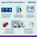 Do Mri Have Side Effects?