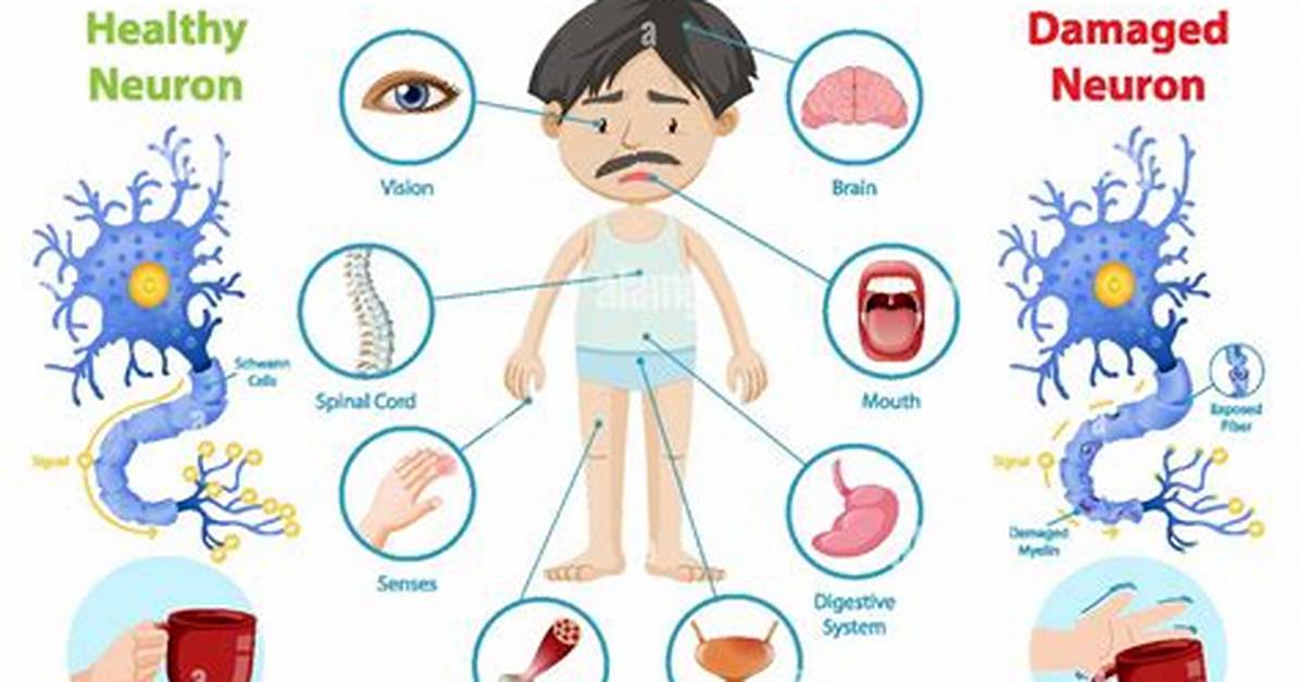 Do Multiple Sclerosis Kill You?