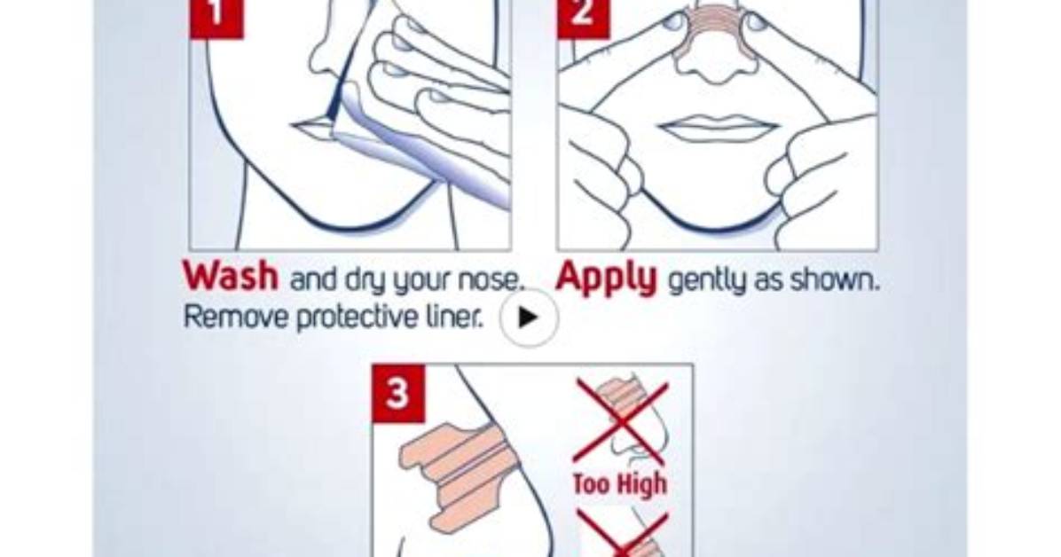 Do Nasal Strips Work?