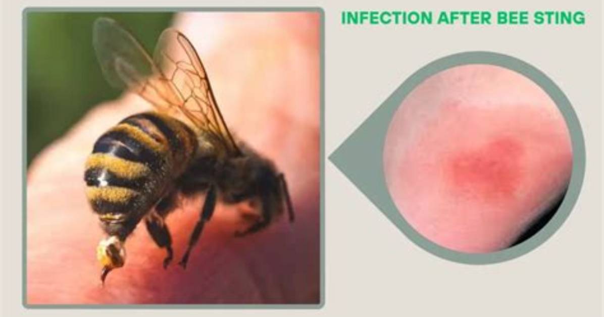 Do Native Bees Sting?