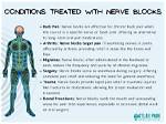 Do Nerve Blocks Hurt?