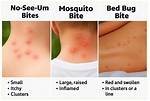 Do No-See-Um Bugs Bite?