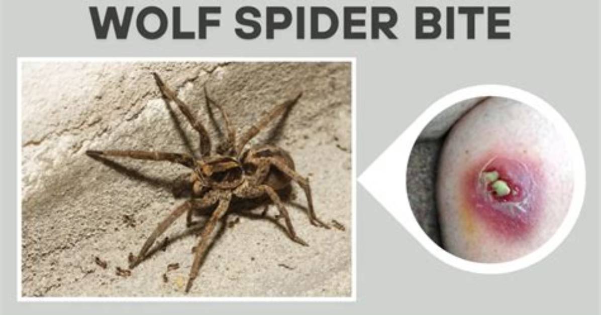 Do Nz Wolf Spiders Bite