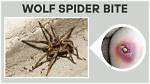 Do Nz Wolf Spiders Bite