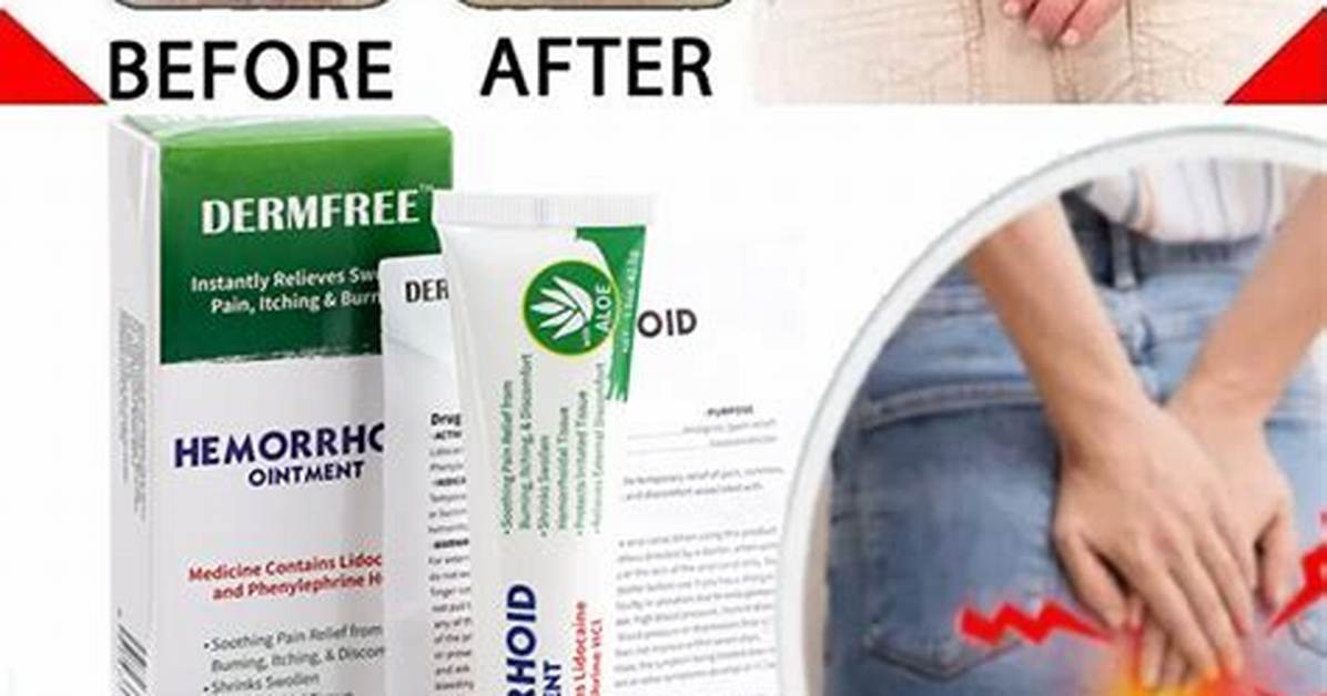 Do Ointment Remove Piles?