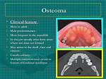 Do Osteomas Get Bigger?