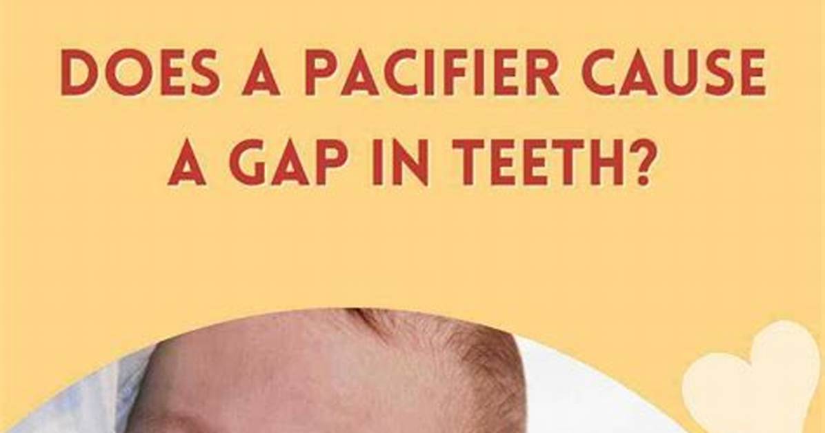 Do Pacifiers Cause Gap Teeth?