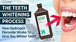Do Peroxide Whiten Teeth?