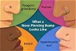 Do Piercing Bumps Hurt
