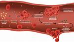 Do Platelets Increase in Dic?