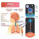 Do Polio Affect Adults?
