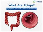 Do Polyps Cause Cramping?
