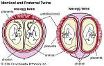 Do Quadruplets Share the Same Placenta?