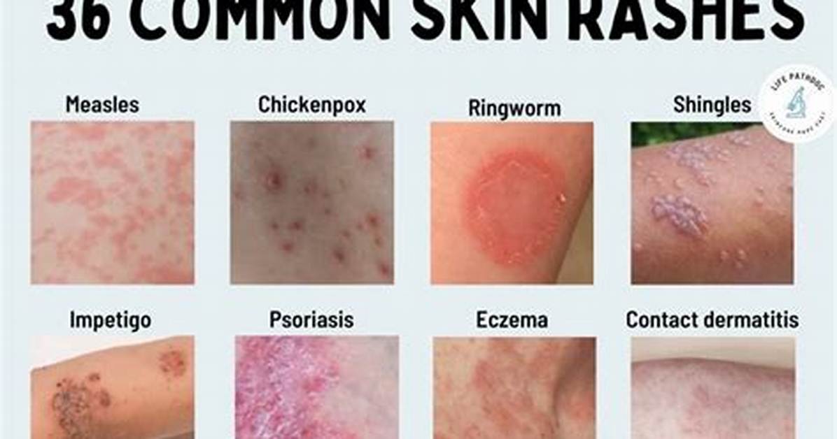 Do Rashes Spread When You Scratch?