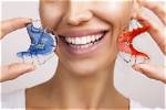 Do Retainers Actually Work