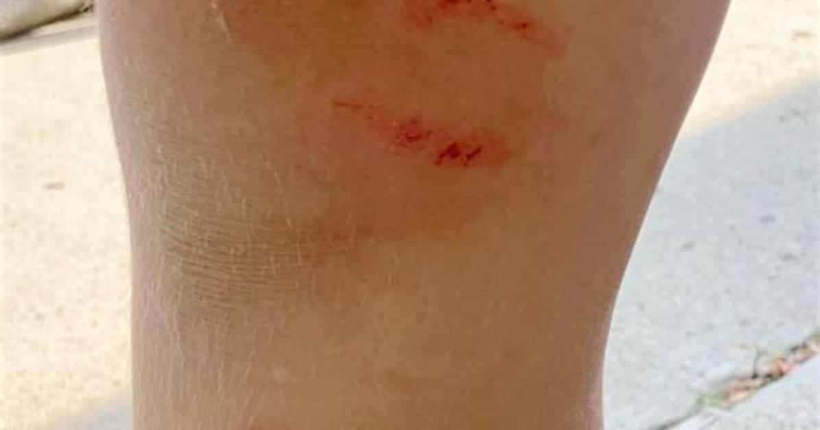 Do Ribbon Fish Bite?