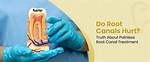 Do Root Canals Really Hurt?