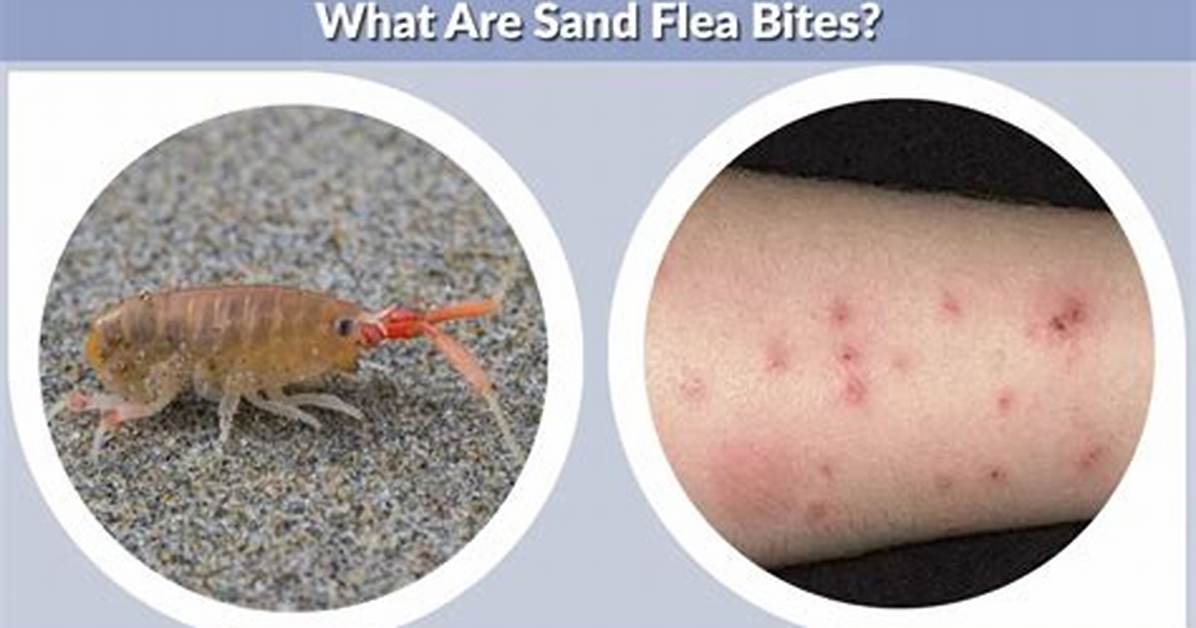 Do Sand Fleas Bite
