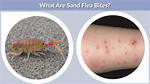 Do Sand Fleas Bite
