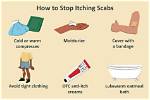 Do Scabs Fall off?