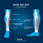Do Shin Splints Throb?