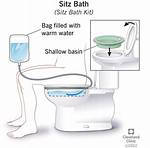 Do Sitz Baths Work?