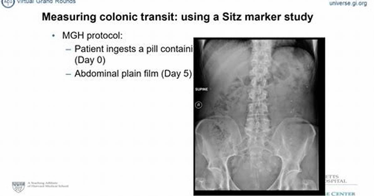 Do Sitz Markers Dissolve?