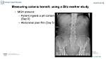 Do Sitz Markers Dissolve?