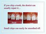 Do Small Tooth Chips Heal?