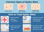 Do Spider Bites Hurt?