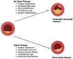Do Statins Cause Capsulitis?
