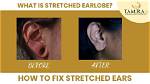 Do Stretched Ears Go Back to Normal?