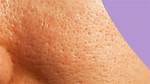 Do Sulfates Clog Pores?