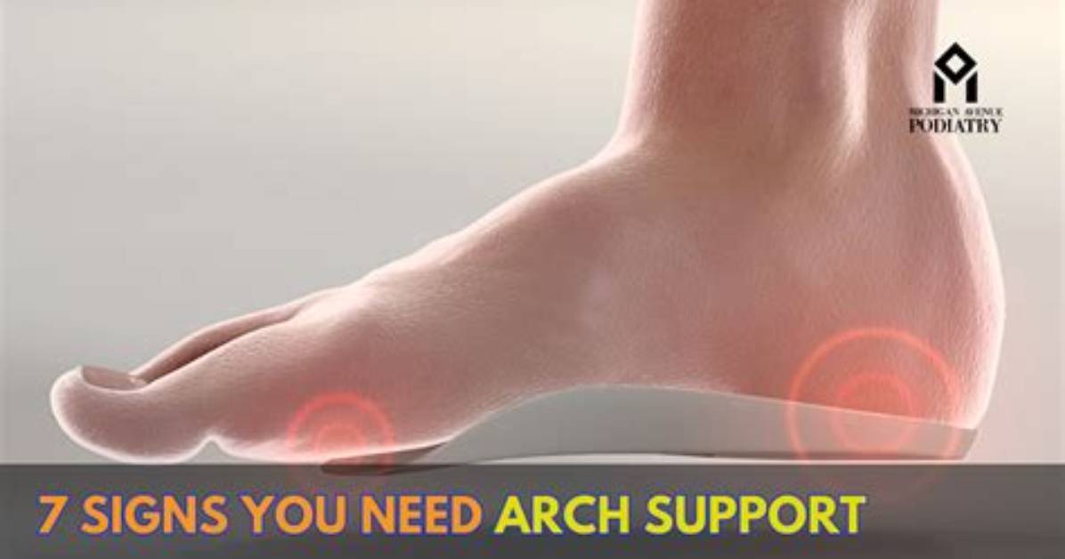 Do Supinators Need Arch Support?