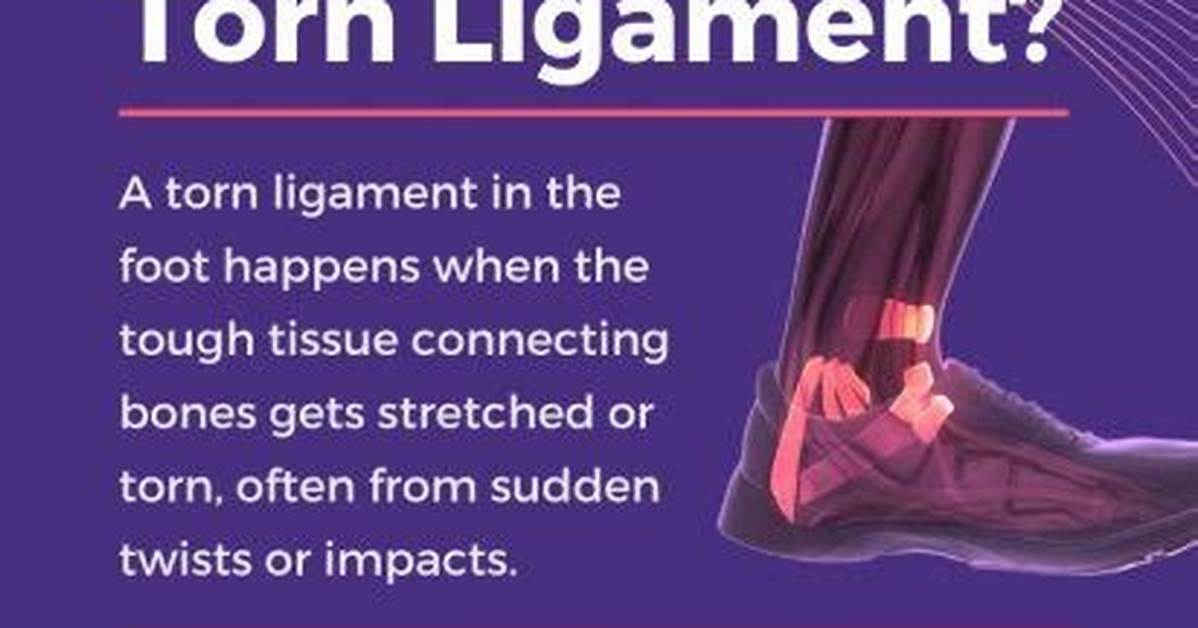 Do Torn Ligaments Require Surgery?