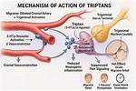 Do Triptans Stop Aura?