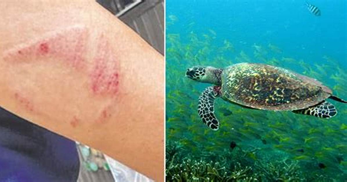 Do Turtles Bite