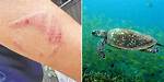 Do Turtles Bite